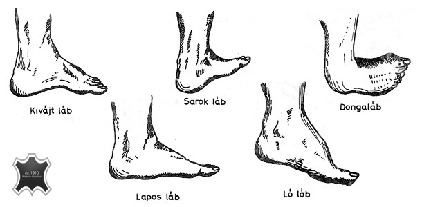 Lábbetegségek