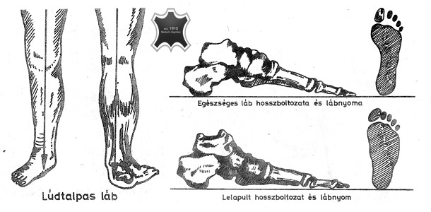 lábbetegségek ízületek mit kell tenni a lábízület fájdalmán